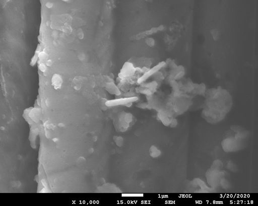 Бактерии на поверхности углеволокна (микробный топливный элемент)